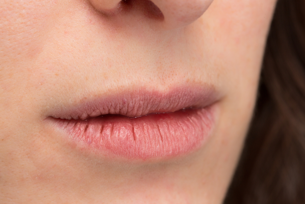 4 Cara Mengatasi Bibir Kering & Pecah-pecah Secara Alami